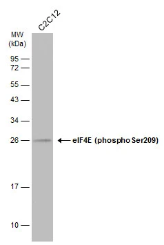 Whole cell extract (30 μg) was separated by 12% SDS-PAGE, and the membrane was blotted with eIF4E (phospho Ser209) antibody (GTX133606) diluted at 1:500. The HRP-conjugated anti-rabbit IgG antibody (GTX213110-01) was used to detect the primary antibody. Whole cell extract (30 μg) was separated by 12% SDS-PAGE, and the membrane was blotted with eIF4E (phospho Ser209) antibody (GTX133606) diluted at 1:500. The HRP-conjugated anti-rabbit IgG antibody (GTX213110-01) was used to detect the primary antibody.