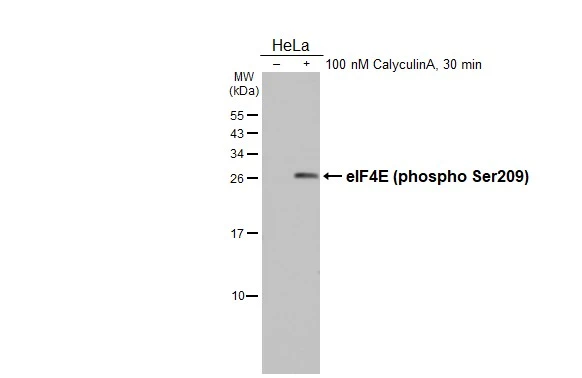 Untreated (–) and treated (+) HeLa whole cell extract (30 μg) were separated by 15% SDS-PAGE, and the membrane was blotted with eIF4E (phospho Ser209) antibody (GTX133606) diluted at 1:1000. The HRP-conjugated anti-rabbit IgG antibody (GTX213110-01) was used to detect the primary antibody. Untreated (–) and treated (+) HeLa whole cell extract (30 μg) were separated by 15% SDS-PAGE, and the membrane was blotted with eIF4E (phospho Ser209) antibody (GTX133606) diluted at 1:1000. The HRP-conjugated anti-rabbit IgG antibody (GTX213110-01) was used to detect the primary antibody.