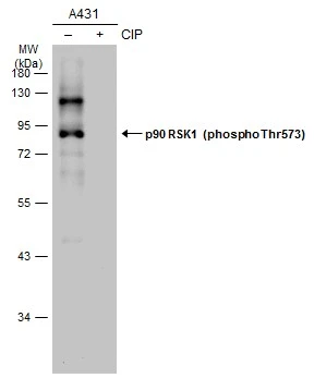 Untreated (–) and treated (+) A431 whole cell extracts (15 μg) were separated by 10% SDS-PAGE, and the membrane was blotted with p90 RSK1 (phospho Thr573) antibody (GTX133612) diluted at 1:1000. The HRP-conjugated anti-rabbit IgG antibody (GTX213110-01) was used to detect the primary antibody. Untreated (–) and treated (+) A431 whole cell extracts (15 μg) were separated by 10% SDS-PAGE, and the membrane was blotted with p90 RSK1 (phospho Thr573) antibody (GTX133612) diluted at 1:1000. The HRP-conjugated anti-rabbit IgG antibody (GTX213110-01) was used to detect the primary antibody.