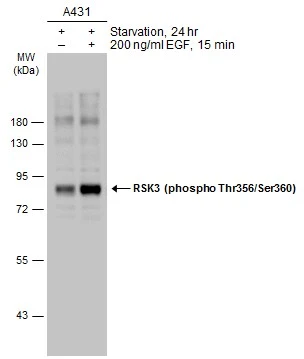 Untreated (–) and treated (+) A431 whole cell extracts (30 μg) were separated by 10% SDS-PAGE, and the membrane was blotted with RSK3 (phospho Thr356/Ser360) antibody (GTX133613) diluted at 1:1000. The HRP-conjugated anti-rabbit IgG antibody (GTX213110-01) was used to detect the primary antibody.