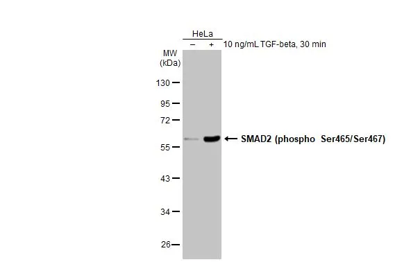 四葉　SDSP Anti-SMAD2 (phospho Ser465/Ser467) antibody (GTX133614