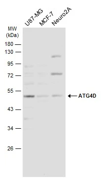 Various whole cell extracts (50 μg) were separated by 10% SDS-PAGE, and the membrane was blotted with ATG4D antibody (GTX133617) diluted at 1:1000. The HRP-conjugated anti-rabbit IgG antibody (GTX213110-01) was used to detect the primary antibody.
