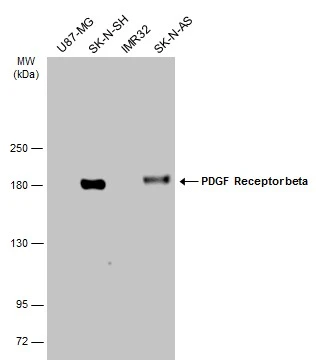 PDGF Receptor beta antibody
