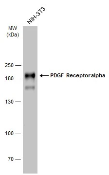 Whole cell extract (40 μg) was separated by 7.5% SDS-PAGE, and the membrane was blotted with PDGF Receptor alpha antibody (GTX133619) diluted at 1:1000. The HRP-conjugated anti-rabbit IgG antibody (GTX213110-01) was used to detect the primary antibody.