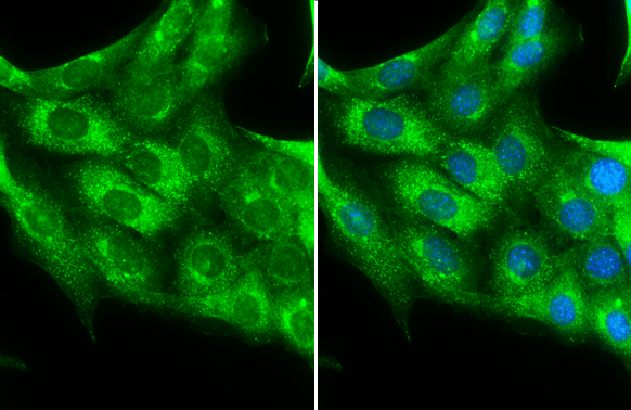PDGF Receptor alpha antibody detects PDGF Receptor alpha protein at cytoplasm by immunofluorescent analysis. Sample: NIH3T3 cells were fixed in 4% paraformaldehyde at RT for 15 min. Green: PDGF Receptor alpha stained by PDGF Receptor alpha antibody (GTX133619) diluted at 1:500. Blue: Hoechst 33342 staining.