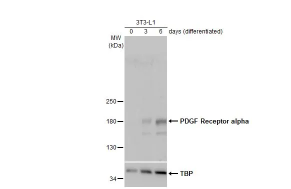 Various whole cell extracts (30 μg) were separated by 5% SDS-PAGE, and the membrane was blotted with PDGF Receptor alpha antibody (GTX133619) diluted at 1:1000. The HRP-conjugated anti-rabbit IgG antibody (GTX213110-01) was used to detect the primary antibody, and the signal was developed with Trident ECL plus-Enhanced.