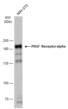 Whole cell extract (40 μg) was separated by 7.5% SDS-PAGE, and the membrane was blotted with PDGF Receptor alpha antibody (GTX133620) diluted at 1:1000. The HRP-conjugated anti-rabbit IgG antibody (GTX213110-01) was used to detect the primary antibody. Whole cell extract (40 μg) was separated by 7.5% SDS-PAGE, and the membrane was blotted with PDGF Receptor alpha antibody (GTX133620) diluted at 1:1000. The HRP-conjugated anti-rabbit IgG antibody (GTX213110-01) was used to detect the primary antibody.