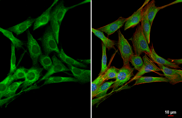 PDGF Receptor alpha antibody detects PDGF Receptor alpha protein at cytoplasm by immunofluorescent analysis. Sample: NIH/3T3 cells were fixed in 4% paraformaldehyde at RT for 15 min. Green: PDGF Receptor alpha stained by PDGF Receptor alpha antibody (GTX133620) diluted at 1:500. Red: phalloidin, a cytoskeleton marker diluted at 1:200. Blue: Hoechst 33342 staining.