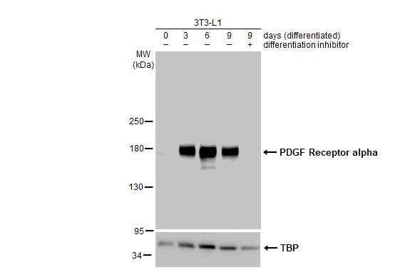 Various whole cell extracts (30 μg) were separated by 5% SDS-PAGE, and the membrane was blotted with PDGF Receptor alpha antibody (GTX133620) diluted at 1:1000. The HRP-conjugated anti-rabbit IgG antibody (GTX213110-01) was used to detect the primary antibody. Various whole cell extracts (30 μg) were separated by 5% SDS-PAGE, and the membrane was blotted with PDGF Receptor alpha antibody (GTX133620) diluted at 1:1000. The HRP-conjugated anti-rabbit IgG antibody (GTX213110-01) was used to detect the primary antibody.