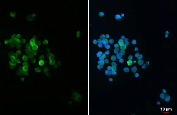 Integrin alpha 4 antibody detects Integrin alpha 4 protein at cell membrane by immunofluorescent analysis. Sample: Jurkat cells were fixed in 4% paraformaldehyde at RT for 15 min. Green: Integrin alpha 4 stained by Integrin alpha 4 antibody (GTX133646) diluted at 1:500. Blue: Fluoroshield with DAPI (GTX30920).