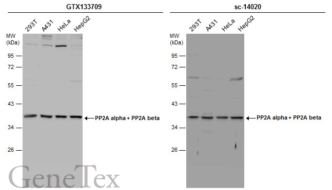 Various whole cell extracts (30 ug) were separated by 10% SDS-PAGE,and the membranes were blotted with PP2A alpha + PP2A beta antibody (GTX133709) diluted at 1:1000 and competitor's antibody (sc-14020) diluted at 1:100.