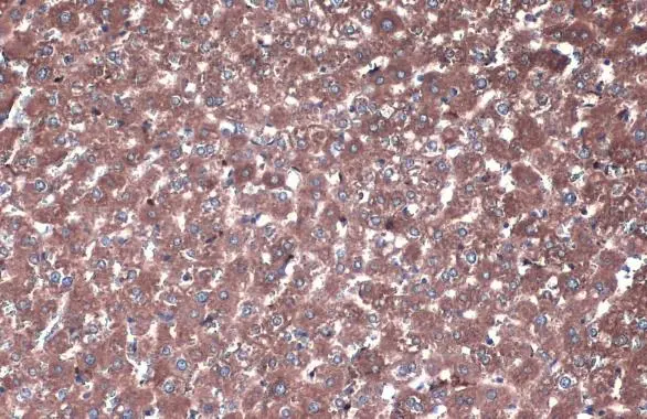 PP2A alpha + PP2A beta antibody detects PP2A alpha + PP2A beta protein at cytoplasm by immunohistochemical analysis. Sample: Paraffin-embedded rat liver. PP2A alpha + PP2A beta stained by PP2A alpha + PP2A beta antibody (GTX133709) diluted at 1:1000. Antigen Retrieval: Citrate buffer, pH 6.0, 15 min