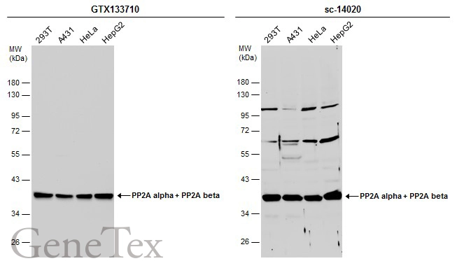 Various whole cell extracts (30 μg) were separated by 10% SDS-PAGE, and the membranes were blotted with PP2A alpha + PP2A beta antibody (GTX133710) diluted at 1:1000 and competitor's antibody (sc-14020) diluted at 1:100. The HRP-conjugated anti-rabbit IgG antibody (GTX213110-01) was used to detect the primary antibody.