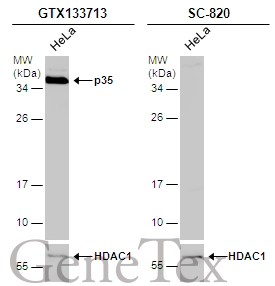 Whole cell extract (30 μg) was separated by 12% SDS-PAGE, and the membranes were blotted with p35 antibody (GTX133713) diluted at 1:1000 and competitor's antibody (SC-820) diluted by 1:100. The HRP-conjugated anti-rabbit IgG antibody (GTX213110-01) was used to detect the primary antibody.