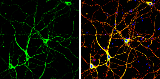 p35 antibody detects p35 protein by immunofluorescent analysis. Sample: DIV10 rat E18 primary cortical neuron cells were fixed in 4% paraformaldehyde at RT for 15 min. Green: p35 stained by p35 antibody (GTX133713) diluted at 1:500. Red: alpha Tubulin, stained by alpha Tubulin antibody [GT114] (GTX628802) diluted at 1:500. Blue: Fluoroshield with DAPI (GTX30920).