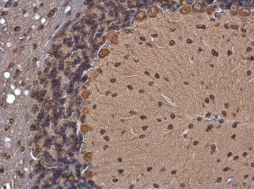 p35 antibody detects p35 protein by immunohistochemical analysis. Sample: Paraffin-embedded mouse brain. p35 stained by p35 antibody (GTX133713) diluted at 1:500. Antigen Retrieval: Citrate buffer, pH 6.0, 15 min