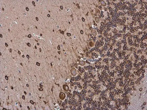 p35 antibody detects p35 protein by immunohistochemical analysis. Sample: Paraffin-embedded rat brain. p35 stained by p35 antibody (GTX133713) diluted at 1:500. Antigen Retrieval: Citrate buffer, pH 6.0, 15 min