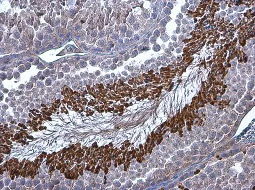 Brachyury antibody