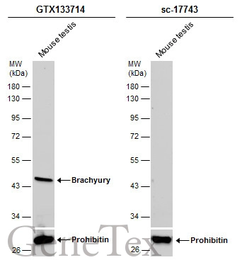 Brachyury antibody