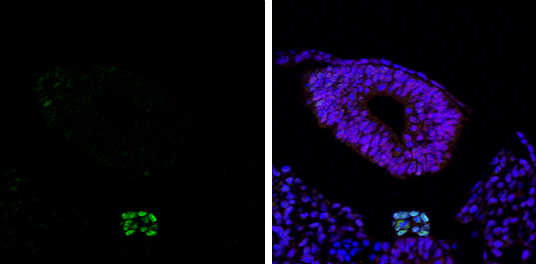 Brachyury antibody