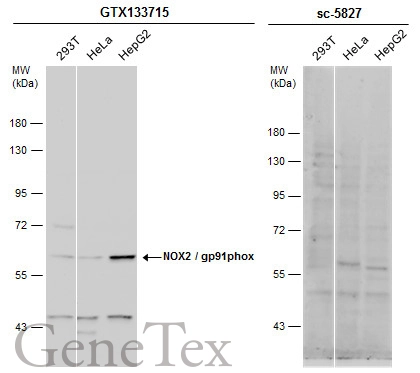 Various whole cell extracts (30 μg) were separated by 7.5% SDS-PAGE, and the membranes were blotted with NOX2 / gp91phox antibody (GTX133715) diluted at 1:1000 and competitor's antibody (sc-5827) diluted at 1:100. The HRP-conjugated anti-rabbit IgG antibody (GTX213110-01) was used to detect the primary antibody.