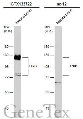 Mouse tissue extract (50 μg) was separated by 5% SDS-PAGE, and the membranes were blotted with TrkB antibody (GTX133722) diluted at 1:1000 and competitor's antibody (sc-12) diluted at 1:100. The HRP-conjugated anti-rabbit IgG antibody (GTX213110-01) was used to detect the primary antibody.