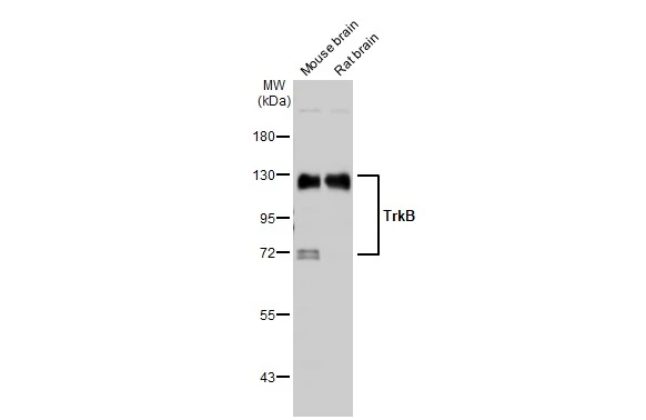 Various tissue extracts (50 μg) were separated by 7.5% SDS-PAGE, and the membrane was blotted with TrkB antibody (GTX133722) diluted at 1:1000. The HRP-conjugated anti-rabbit IgG antibody (GTX213110-01) was used to detect the primary antibody.