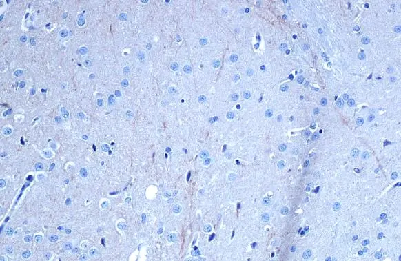 TrkB antibody detects TrkB protein at cell membrane by immunohistochemical analysis. Sample: Paraffin-embedded rat brain. TrkB stained by TrkB antibody (GTX133722) diluted at 1:500. Antigen Retrieval: Citrate buffer, pH 6.0, 15 min