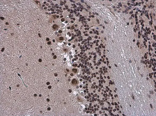 SMARCA2 antibody detects SMARCA2 protein at nucleus in mouse brain by immunohistochemical analysis. Sample: Paraffin-embedded mouse brain. SMARCA2 antibody (GTX133724) diluted at 1:500. 
 Antigen Retrieval: Citrate buffer, pH 6.0, 15 min