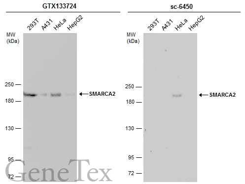 Various whole cell extracts (30 μg) were separated by 5% SDS-PAGE, and the membranes were blotted with SMARCA2 antibody (GTX133724) diluted at 1:1000 and competitor's antibody (sc-6450) diluted at 1:100. The HRP-conjugated anti-rabbit IgG antibody (GTX213110-01) was used to detect the primary antibody.