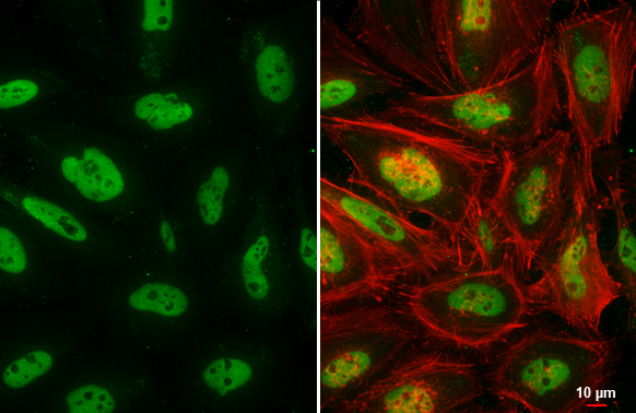 SMARCA2 antibody detects SMARCA2 protein at nucleus by immunofluorescent analysis. Sample: HeLa cells were fixed in 4% paraformaldehyde at RT for 15 min. Green: SMARCA2 stained by SMARCA2 antibody (GTX133724) diluted at 1:500. Red: phalloidin, a cytoskeleton marker, diluted at 1:200. Scale bar= 10 μm.