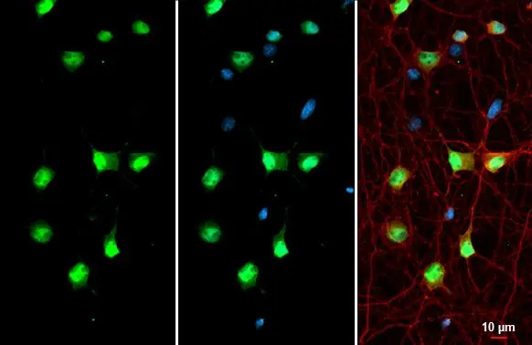 SMARCA2 antibody detects SMARCA2 protein at nucleolus by immunofluorescent analysis. Sample: DIV10 rat hippocampal neuron cells were fixed in 4% paraformaldehyde at RT for 15 min. Green: SMARCA2 stained by SMARCA2 antibody (GTX133724) diluted at 1:500. Red: Tau, a marker, stained by Tau antibody [GT287] (GTX634809) diluted at 1:500.