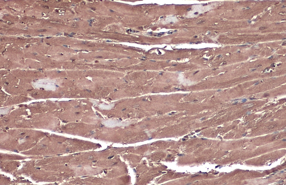 C3G antibody detects C3G protein at cytoplasm by immunohistochemical analysis. Sample: Paraffin-embedded mouse heart. C3G stained by C3G antibody (GTX133726) diluted at 1:500. Antigen Retrieval: Citrate buffer, pH 6.0, 15 min