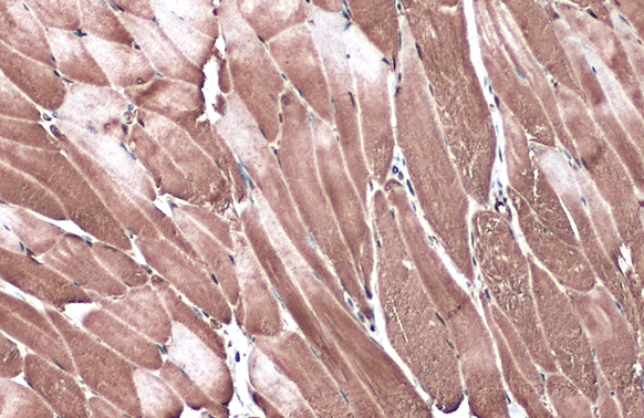 C3G antibody detects C3G protein at cytoplasm by immunohistochemical analysis. Sample: Paraffin-embedded mouse muscle. C3G stained by C3G antibody (GTX133726) diluted at 1:500. Antigen Retrieval: Citrate buffer, pH 6.0, 15 min