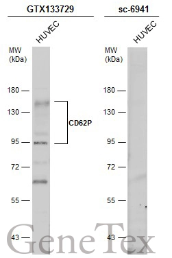 Whole cell extract (30 μg) was separated by 7.5% SDS-PAGE, and the membranes were blotted with CD62P antibody (GTX133729) diluted at 1:500 and competitor's antibody (sc-6941) diluted at 1:50. The HRP-conjugated anti-rabbit IgG antibody (GTX213110-01) was used to detect the primary antibody.