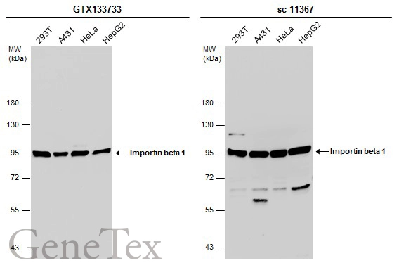 Various whole cell extracts (30 μg) were separated by 7.5% SDS-PAGE, and the membranes were blotted with Importin beta 1 antibody (GTX133733) diluted at 1:1000 and competitor's antibody (sc-11367) diluted at 1:100. The HRP-conjugated anti-rabbit IgG antibody (GTX213110-01) was used to detect the primary antibody.
