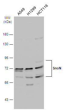 Various whole cell extracts (30 μg) were separated by 7.5% SDS-PAGE, and the membrane was blotted with SnoN antibody (GTX133735) diluted at 1:1000. The HRP-conjugated anti-rabbit IgG antibody (GTX213110-01) was used to detect the primary antibody.