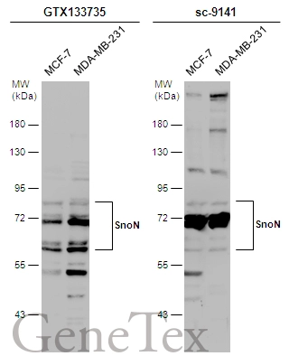 Various whole cell extracts (30 μg) were separated by 7.5% SDS-PAGE, and the membranes were blotted with SnoN antibody (GTX133735) diluted at 1:1000 and competitor's antibody (sc-9141) diluted at 1:1000. The HRP-conjugated anti-rabbit IgG antibody (GTX213110-01) was used to detect the primary antibody.
