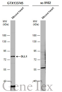 Mouse tissue extract (50 μg) was separated by 7.5% SDS-PAGE, and the membranes were blotted with DLL1 antibody (GTX133745) diluted at 1:500 and competitor's antibody (sc-9102) diluted at 1:100. The HRP-conjugated anti-rabbit IgG antibody (GTX213110-01) was used to detect the primary antibody.