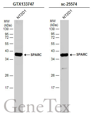 Whole cell extract (30 μg) was separated by 12% SDS-PAGE, and the membranes were blotted with SPARC antibody (GTX133747) diluted at 1:1000 and competitor's antibody (sc-25574) diluted at 1:1000. The HRP-conjugated anti-rabbit IgG antibody (GTX213110-01) was used to detect the primary antibody.