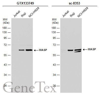 Various whole cell extracts (30 μg) were separated by 10% SDS-PAGE, and the membranes were blotted with WASP antibody (GTX133749) diluted at 1:1000 and competitor's antibody (sc-8353) diluted at 1:500. The HRP-conjugated anti-rabbit IgG antibody (GTX213110-01) was used to detect the primary antibody.
