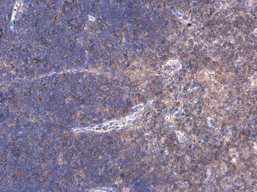 WASP antibody detects WASP protein at cytoplasm by immunohistochemical analysis. Sample: Paraffin-embedded mouse thymus. WASP stained by WASP antibody (GTX133749) diluted at 1:500.
Antigen Retrieval: Citrate buffer, pH 6.0, 15 min WASP antibody detects WASP protein at cytoplasm by immunohistochemical analysis. Sample: Paraffin-embedded mouse thymus. WASP stained by WASP antibody (GTX133749) diluted at 1:500.
Antigen Retrieval: Citrate buffer, pH 6.0, 15 min