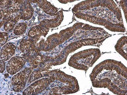 K.M.様 Anti-TOMM20 antibody (GTX133756) | GeneTex