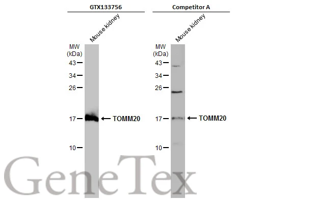 K.M.様 Anti-TOMM20 antibody (GTX133756) | GeneTex