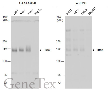 Various whole cell extracts (30 μg) were separated by 5% SDS-PAGE, and the membranes were blotted with IRS2 antibody (GTX133760) diluted at 1:1000 and competitor's antibody (sc-8299) diluted at 1:100. The HRP-conjugated anti-rabbit IgG antibody (GTX213110-01) was used to detect the primary antibody.
