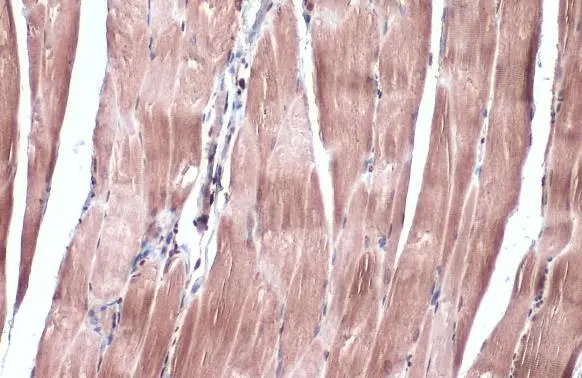 IRS2 antibody detects IRS2 protein at cytoplasm by immunohistochemical analysis. Sample: Paraffin-embedded mouse muscle. IRS2 stained by IRS2 antibody (GTX133760) diluted at 1:100. Antigen Retrieval: Citrate buffer, pH 6.0, 15 min IRS2 antibody detects IRS2 protein at cytoplasm by immunohistochemical analysis. Sample: Paraffin-embedded mouse muscle. IRS2 stained by IRS2 antibody (GTX133760) diluted at 1:100. Antigen Retrieval: Citrate buffer, pH 6.0, 15 min