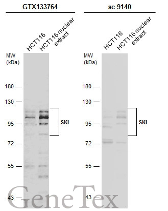 HCT116 whole cell and nuclear extracts (30 μg) were separated by 7.5% SDS-PAGE, and the membranes were blotted with SKI antibody (GTX133764) diluted at 1:1000 and competitor's antibody (sc-9140) diluted at 1:200. The HRP-conjugated anti-rabbit IgG antibody (GTX213110-01) was used to detect the primary antibody.