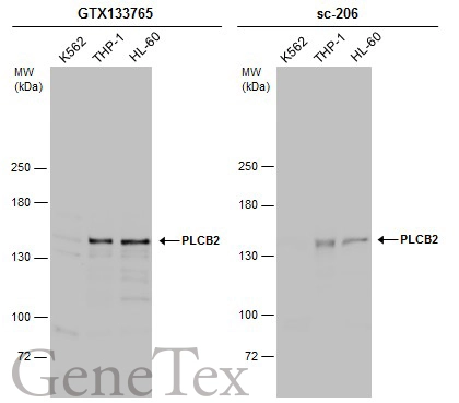 Various whole cell extracts (30 μg) were separated by 5% SDS-PAGE, and the membranes were blotted with PLCB2 antibody (GTX133765) diluted at 1:1000 and competitor's antibody (sc-206) diluted at 1:100. The HRP-conjugated anti-rabbit IgG antibody (GTX213110-01) was used to detect the primary antibody. Various whole cell extracts (30 μg) were separated by 5% SDS-PAGE, and the membranes were blotted with PLCB2 antibody (GTX133765) diluted at 1:1000 and competitor's antibody (sc-206) diluted at 1:100. The HRP-conjugated anti-rabbit IgG antibody (GTX213110-01) was used to detect the primary antibody.