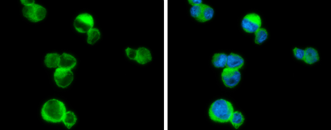PLCB2 antibody detects PLCB2 protein at cytoplasm by immunofluorescent analysis. Sample: THP-1 cells were fixed in 4% paraformaldehyde at RT for 15 min. Green: PLCB2 stained by PLCB2 antibody (GTX133765) diluted at 1:500. Blue: Fluoroshield with DAPI (GTX30920). PLCB2 antibody detects PLCB2 protein at cytoplasm by immunofluorescent analysis. Sample: THP-1 cells were fixed in 4% paraformaldehyde at RT for 15 min. Green: PLCB2 stained by PLCB2 antibody (GTX133765) diluted at 1:500. Blue: Fluoroshield with DAPI (GTX30920).