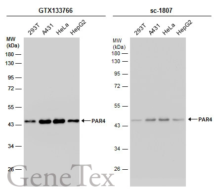 Various whole cell extracts (30 μg) were separated by 10% SDS-PAGE, and the membranes were blotted with PAR4 antibody (GTX133766) diluted at 1:1000 and competitor's antibody (sc-1807) diluted at 1:1000. The HRP-conjugated anti-rabbit IgG antibody (GTX213110-01) was used to detect the primary antibody, and the signal was developed with Trident ECL plus-Enhanced.